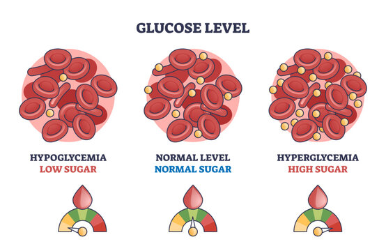 Glucose level with low, normal and high sugar in blood outline diagram, transparent background. Labeled educational scheme with hypoglycemia and hyperglycemia problem monitoring illustration.