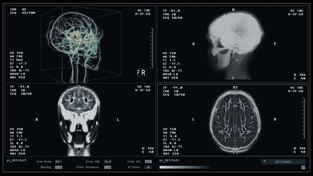 Diagnostic system deals with organ examination by scanning head. Diagnostic examination of the human organs. Medical diagnostic software thoroughly examining the damaged patients brain organ. X-ray.