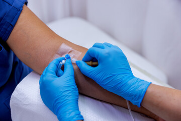 A patient with serum administered in the hospital. Serum is given to the patient. The serum that the nurse makes to her patient. While the doctor opens a vascular access to the patient.