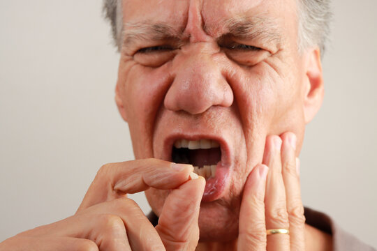 Man holding up and demonstrating his chipped tooth between his fingers.