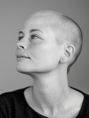 Strength and Beauty in Simplicity - Documentary-style Portrait of a Bald Woman