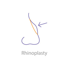 Rhinoplasty, Nose Surgery, Nose Job, Nose Reshaping, Cosmetic Surgery, Facial Surgery, Rhinoplasty Icon, Rhinoplasty Vector, with editable stroke.