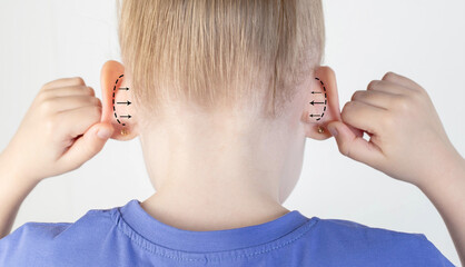Lop-eared girl holding her ears on a white background. The concept of changing the shape and size of the ears using plastic surgery. Pediatric otoplasty, close-up