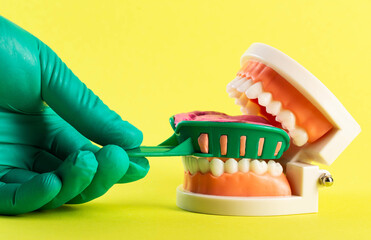 A doctor's hand in a green medical glove holds a dental spoon with an alginate plastic mass for making a plaster cast of the patient's jaw. Malocclusion