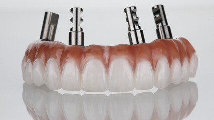 perfect dental prosthesis with zircon gum and orthopedic transfers on a white background