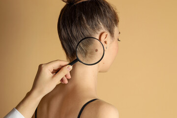 Doctor examining woman's mole with magnifying glass on beige background, closeup