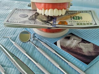 Dental instruments, money and x-ray on blue paper