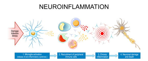 Neuroinflammation. Development of Neurodegenerative Diseases