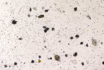 Uric acid crystals and calcium oxalate monohydrate under microscope