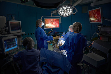 Team of surgeons doing laparoscopic surgery, looking at monitor