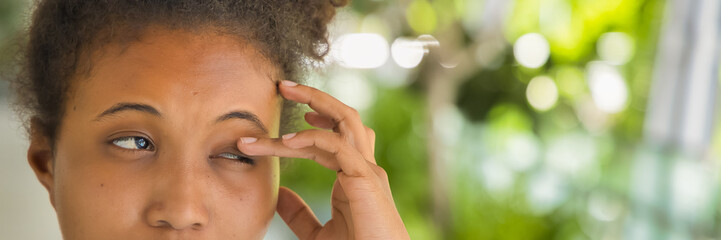 Young African woman suffering from irritated eye; concept of optical health care, red eye allergy,...