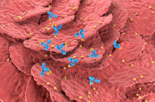 Monoclonal antibody therapy in Psoriasis - isometric view 3d illustration