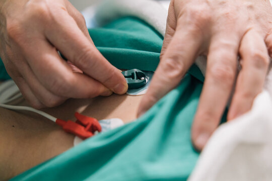 Close-up of hands attaching ECG electrodes to a patient's chest in a hospital setting