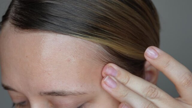 Young caucasian woman touching the face with her hand showing greasy skin on her forehead and pimples on a dark grey background. Cosmetology and beauty concept. Oily skin, acne, shine on the face