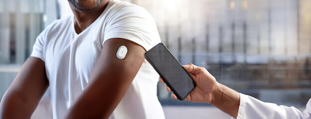 A close-up of a person's arm with a wearable device of real-time control of health through continuous glucose monitoring CGM system being scanned by a smartphone, showcasing health technology.