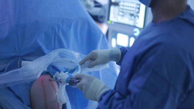 Arthroscopy of the shoulder joint