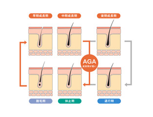 AGAヘアサイクル線