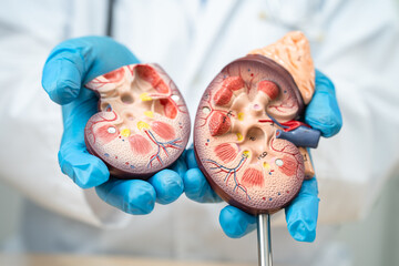 Kidney disease, Chronic kidney disease ckd, Doctor hold human model to treat and study in hospital.