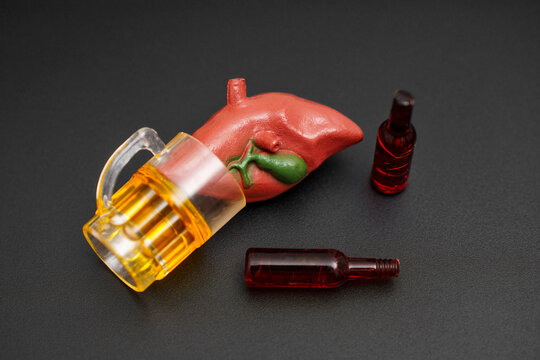 Alcohol and Liver Model Illustrating Health Risks