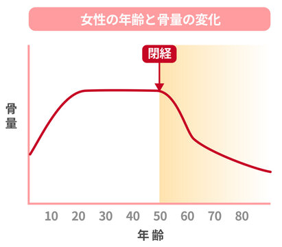 女性の年齢別の骨量の変化のグラフ、閉経と骨粗鬆症の関係。