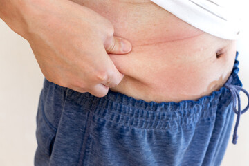 お腹の脂肪を指でつまむ中年男性