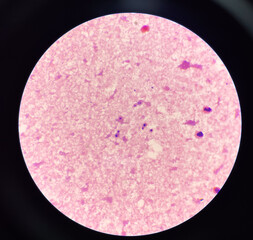 Yeast cell