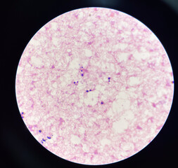 Yeast cell