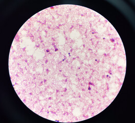 Yeast cell