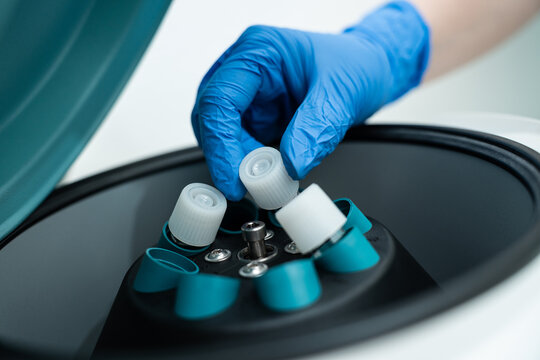 Young female reproductive endocrinologist or gynecologist working in a medical lab for research of reproductive medicine, including infertility treatment and human fertility preservation.