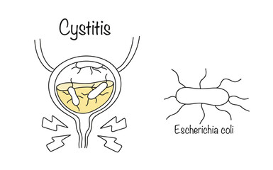 Escherichia coli