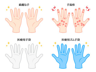 Fototapeta premium 綺麗な手と手湿疹と医療用ゴム手袋のイラスト素材セット