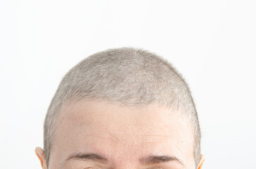 Fototapeta premium Regrowth Journey: 62-Year-Old Woman's Hair Begins to Return 70 Days Post-Chemotherapy, Captured in Close-Up Photo.