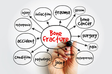 Bone fracture mind map, concept for presentations and reports