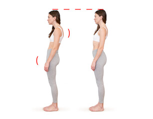Comparison of good and bad posture. Problems of slouching, curvature of the spine