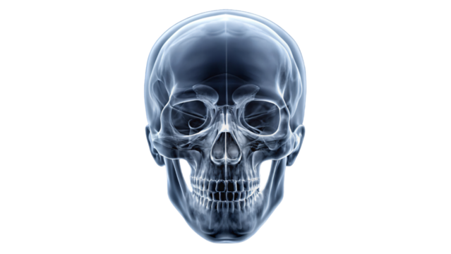 An X-ray image showing a detailed view of a human skull and head with anatomical features and medical details