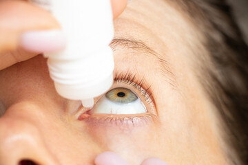 Young girl puts drops in her eyes at home, moisturizes her eyes, dry eye problem, eye