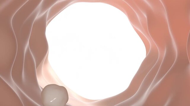3D inside the large intestines colonoscopy intesti