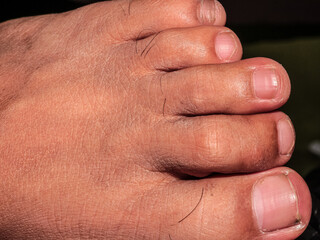 Fototapeta premium Male feet with clean white nails with brown skin color