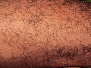 Hair on human skin, shin of hairy man's leg