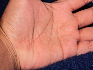 Obraz premium Closeup view of horizontal simian line on the palm of hand