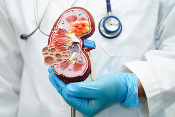 Chronic kidney disease, doctor with model for treatment urinary system, urology, Estimated...