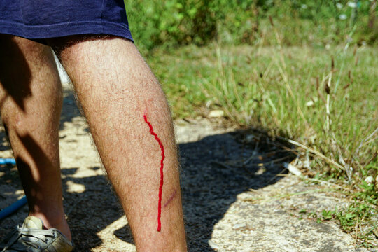 Minor injuries during outdoor activities: photo of a man's legs with a bleeding small cut on the calf, taken against the background of a road and grass.