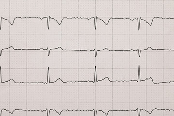 Badanie ekg wyniki na papierze © Paweł Kacperek