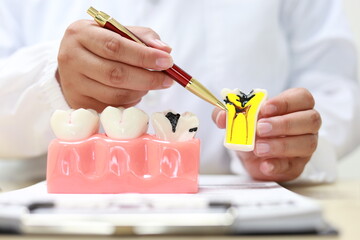Gums and teeth are essential for oral health. Gums provide a protective covering for tooth roots,...