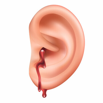 "Arterial Bleeding" Images – Browse 245,120 Stock Photos, Vectors, and