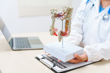 A doctor holds a human colon anatomy model, demonstrating the digestive system's structure to...