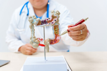 A doctor holds a human colon anatomy model, demonstrating the digestive system's structure to...