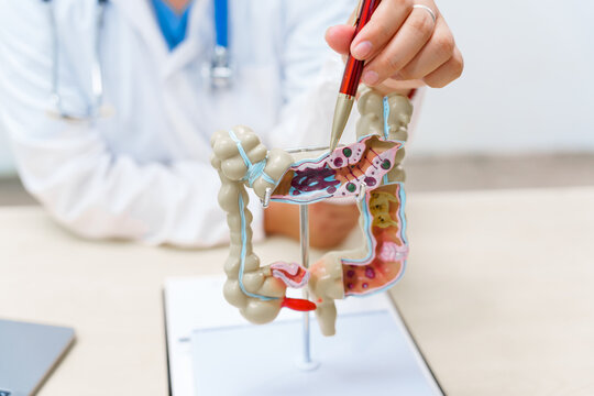 A doctor holds a human colon anatomy model, demonstrating the digestive system's structure to diagnose and treat various gastrointestinal diseases and conditions.