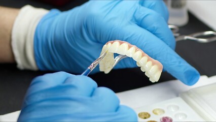 Zirconium porcelain and implant studies in the Dental Laboratory