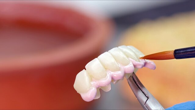 Zirconium porcelain and implant studies in the Dental Laboratory